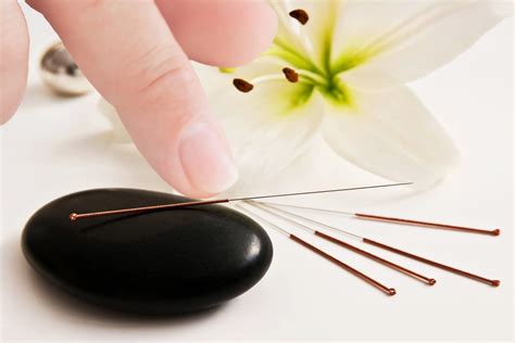Acupuncture