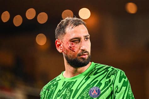 Gianluigi Donnarumma blessé