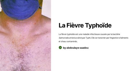 Infographie sur la fièvre typhoïde