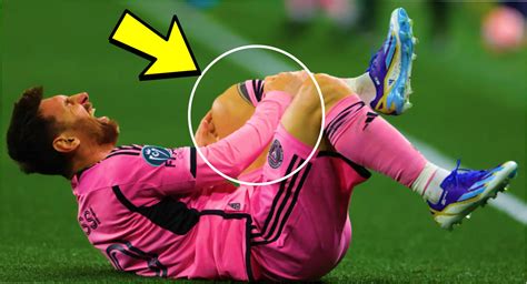 Messi blessé