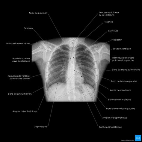 Radiographie